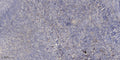 Anti-C5orf46 antibody (22-72 aa) (STJ196569) – Figure 1 of 1