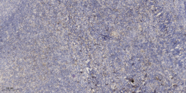 Anti-C5orf46 antibody (22-72 aa) (STJ196569) – Figure 1 of 1