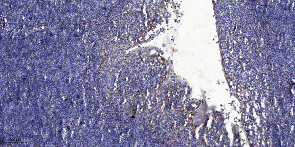 Anti-SCGB1D4 antibody (28-78 aa) (STJ196570) – Figure 1 of 1