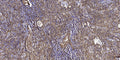 Anti-USH2A antibody (3731-3781 aa) (STJ196571) – Figure 1 of 1