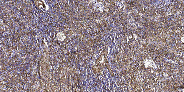 Anti-USH2A antibody (3731-3781 aa) (STJ196571) – Figure 1 of 1