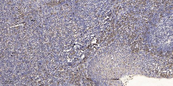 Anti-FAM66E antibody (1-24 aa) (STJ196572) – Figure 1 of 1