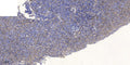 Anti-YE014 antibody (13-63 aa) (STJ196574) – Figure 1 of 1