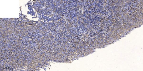 Anti-YE014 antibody (13-63 aa) (STJ196574) – Figure 1 of 1