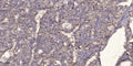 Anti-ATP5MF antibody (38-88 aa) (STJ196576) – Figure 1 of 1