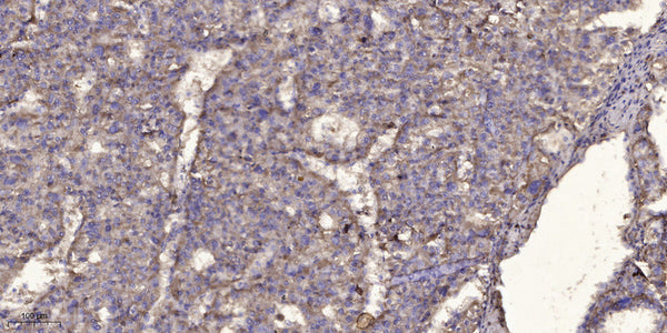 Anti-ATP5MF antibody (38-88 aa) (STJ196576) – Figure 1 of 1