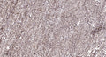 Anti-CHD7 antibody (1703-1753 aa) (STJ196604) – Figure 1 of 1