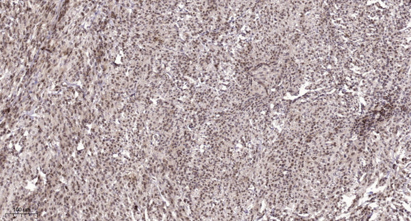 Anti-CHD7 antibody (1703-1753 aa) (STJ196604) – Figure 1 of 1