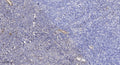 Anti-ENHO antibody (15-65 aa) (STJ196614) – Figure 1 of 1