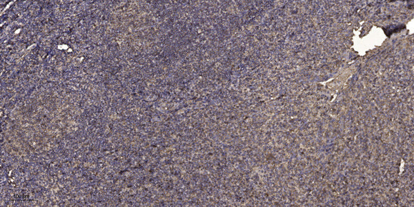 Anti-DEFB106A/DEFB106B antibody (1-51 aa) (STJ196616) – Figure 1 of 1