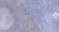 Anti-WFDC13 antibody (28-78 aa) (STJ196618) – Figure 1 of 1