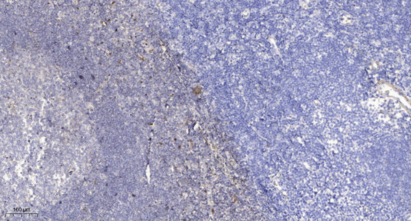 Anti-WFDC13 antibody (28-78 aa) (STJ196618) – Figure 1 of 1