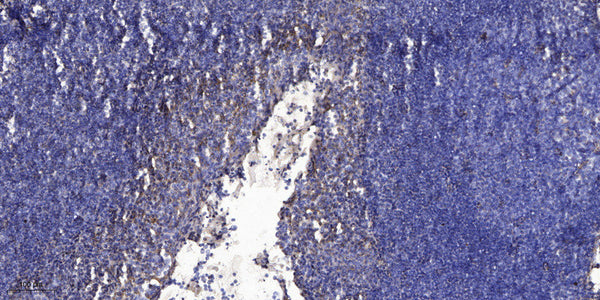 Anti-GHRH antibody (43-93 aa) (STJ196624) – Figure 1 of 1