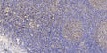 Anti-RNASEK antibody (27-77 aa) (STJ196630) – Figure 1 of 1
