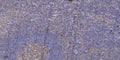 Anti-YJ009 antibody (19-69 aa) (STJ196634) – Figure 1 of 1