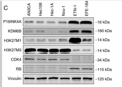 Anti-Tri-Methyl-Histone H3-Lys27 antibody (STJ197288) – Figure 1 of 1