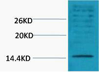 Anti-Di-Methyl-Histone H3-Lys18 antibody (STJ197295) – Figure 1 of 1