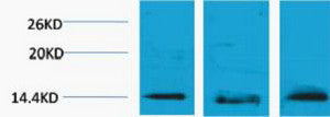 Anti-Tri-Methyl-Histone H2B-Lys5 antibody (STJ197297) – Figure 1 of 1