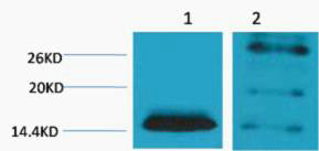 Anti-Di-Methyl-Histone H2B-Lys5 antibody (STJ197299) – Figure 1 of 1