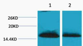 Anti-Di-Methyl-Histone H1-Lys25 antibody (STJ197302) – Figure 1 of 1