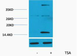 Anti-Acetyl-Histone H3-Lys4 antibody (STJ197306) – Figure 1 of 1