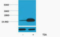 Anti-Acetyl-Histone H2B-Lys12 antibody (STJ197310) – Figure 1 of 1