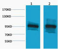 Anti-CTNNB1 antibody (STJ197317) – Figure 1 of 1