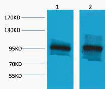Anti-CTNNB1 antibody (STJ197317) – Figure 1 of 1