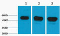 Anti-TUBB3 antibody (134-184 aa) (STJ197319) – Figure 1 of 1
