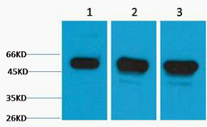 Anti-TUBB3 antibody (134-184 aa) (STJ197319) – Figure 1 of 1