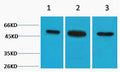 Anti-TUBB2A antibody (80-130 aa) (STJ197320) – Figure 1 of 1