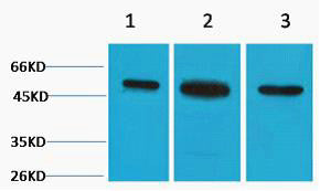 Anti-TUBB2A antibody (80-130 aa) (STJ197320) – Figure 1 of 1
