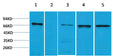 Anti-ZBTB45 antibody (STJ197322) – Figure 1 of 1