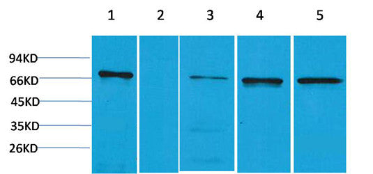 Anti-ZBTB45 antibody (STJ197322) – Figure 1 of 1