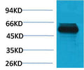 Anti-TRIM72 antibody (STJ197325) – Figure 1 of 1