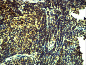 Anti-TLR8 antibody (STJ197326) – Figure 1 of 1