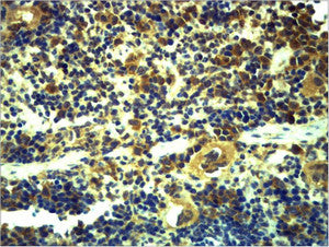 Anti-TLR6 antibody (STJ197327) – Figure 1 of 1