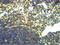 Anti-TLR2 antibody (STJ197329) – Figure 1 of 1