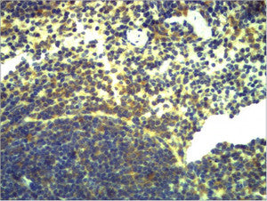 Anti-TLR2 antibody (STJ197329) – Figure 1 of 1
