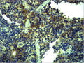 Anti-TLR1 antibody (STJ197331) – Figure 1 of 1