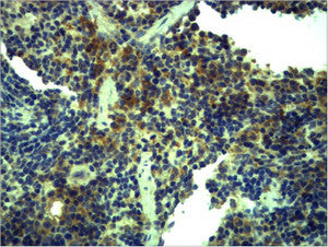 Anti-TLR1 antibody (STJ197331) – Figure 1 of 1