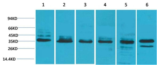 Anti-TBP antibody (STJ197332) – Figure 1 of 1