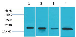 Anti-SOD1 antibody (STJ197333) – Figure 1 of 1