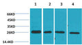 Anti-SNAI2 antibody (STJ197334) – Figure 1 of 1