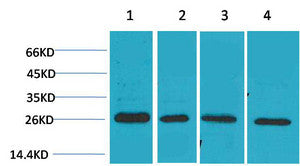 Anti-SNAI2 antibody (STJ197334) – Figure 1 of 1