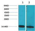 Anti-S100B antibody (STJ197336) – Figure 1 of 1