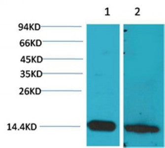 Anti-S100B antibody (STJ197336) – Figure 1 of 1