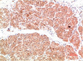 Anti-PIK3R1 antibody (STJ197340) – Figure 1 of 1