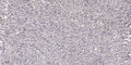 Anti-UCHL1 antibody (STJ197341) – Figure 1 of 1