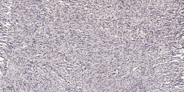 Anti-UCHL1 antibody (STJ197341) – Figure 1 of 1